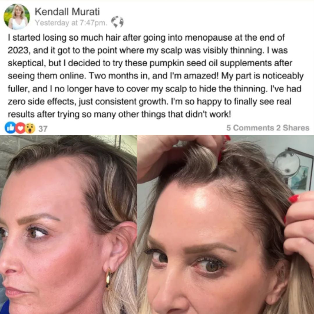 Supports Hair Health & Hormone Balance Complex